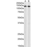 Western Blot - Anti-DBC-1 Antibody (A85218) - Antibodies.com