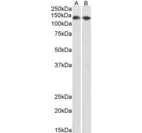 Western Blot - Anti-CCAR2 Antibody (A85218) - Antibodies.com