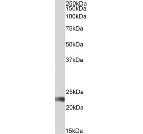 Western Blot - Anti-CD3G Antibody (A85219) - Antibodies.com