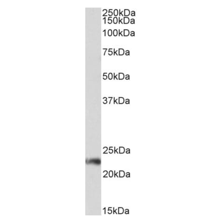 Western Blot - Anti-CD3G Antibody (A85219) - Antibodies.com