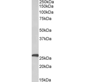 Western Blot - Anti-CFD Antibody (A85223) - Antibodies.com