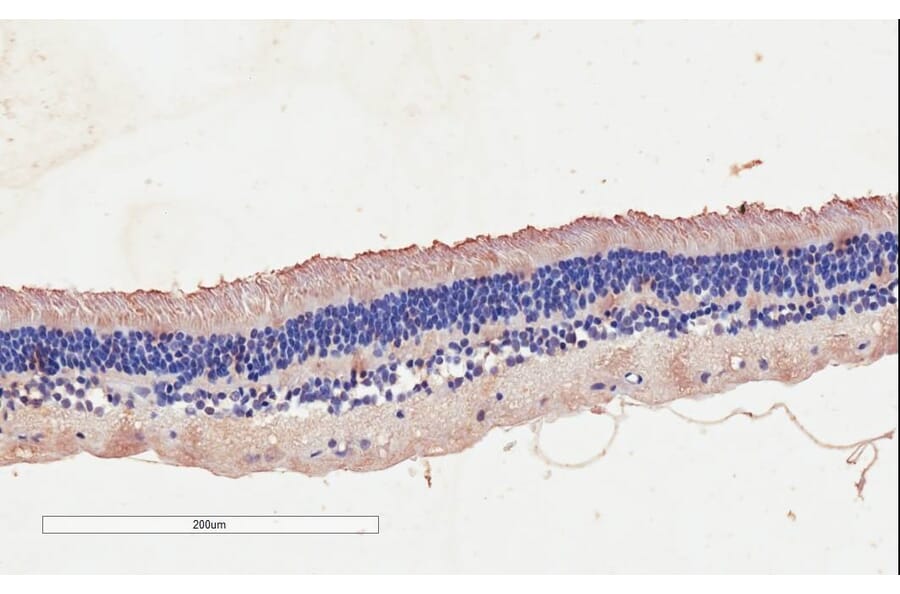 Immunohistochemistry - Anti-CNGB3 Antibody (A85225) - Antibodies.com