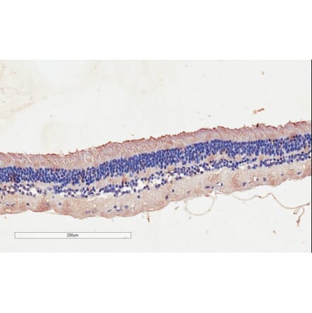 Immunohistochemistry - Anti-CNGB3 Antibody (A85225) - Antibodies.com