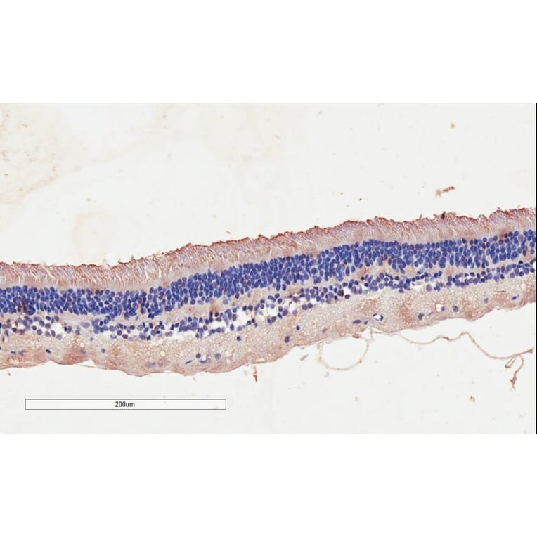 Immunohistochemistry - Anti-CNGB3 Antibody (A85225) - Antibodies.com
