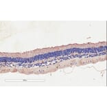 Immunohistochemistry - Anti-CNGB3 Antibody (A85225) - Antibodies.com