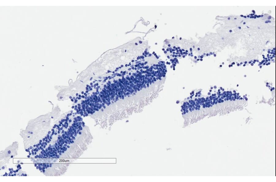 Immunohistochemistry - Anti-CNGB3 Antibody (A85225) - Antibodies.com
