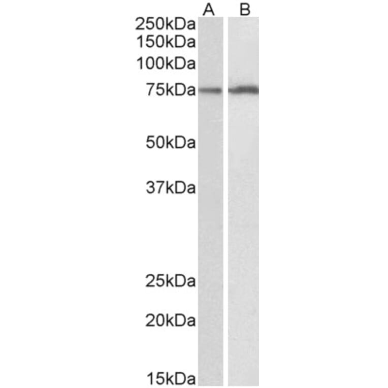 Western Blot - Anti-Cytochrome P450 2B6/CYP2B6 Antibody (A85226) - Antibodies.com