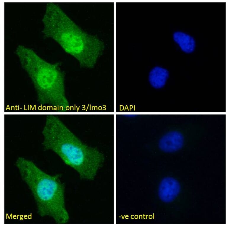 Immunofluorescence - Anti-LIM Domain Only 3 Antibody (A85227) - Antibodies.com