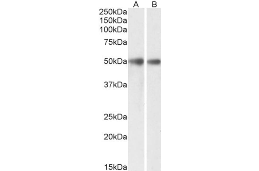 Western Blot - Anti-GDE1 (MIR16) Antibody (A85229) - Antibodies.com