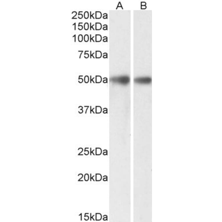 Western Blot - Anti-GDE1 (MIR16) Antibody (A85229) - Antibodies.com