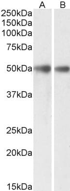 Anti-GDE1 Antibody (A85229) (0.3µg/ml) staining of Mouse (A) and Rat (B) Brain lysates (35µg protein in RIPA buffer). Primary incubation was 1 hour. Detected by chemiluminescence.