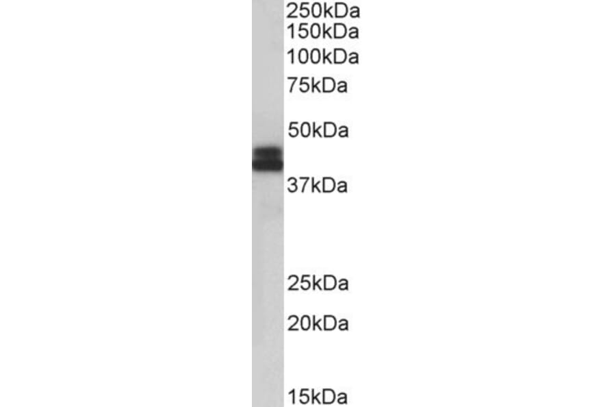 Western Blot - Anti-HLA B Antibody (A85234) - Antibodies.com
