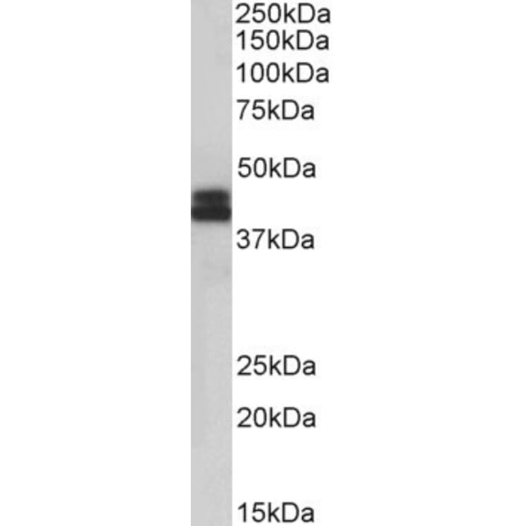 Western Blot - Anti-HLA B Antibody (A85234) - Antibodies.com