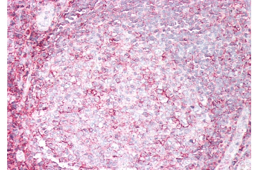 Immunohistochemistry - Anti-HLA B Antibody (A85234) - Antibodies.com