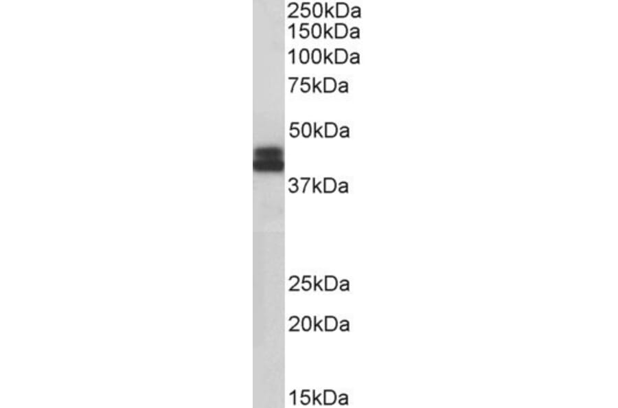 Western Blot - Anti-HLA B Antibody (A85235) - Antibodies.com