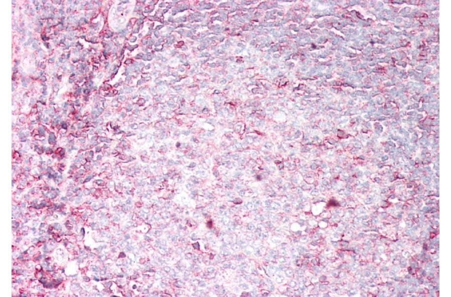 Immunohistochemistry - Anti-HLA B Antibody (A85235) - Antibodies.com