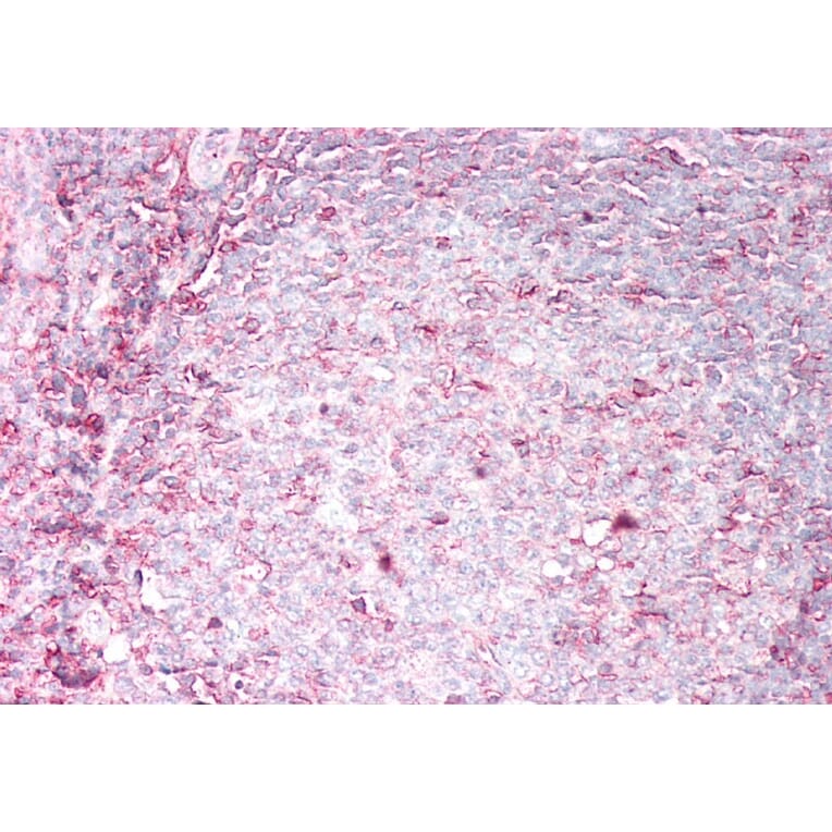 Immunohistochemistry - Anti-HLA B Antibody (A85235) - Antibodies.com