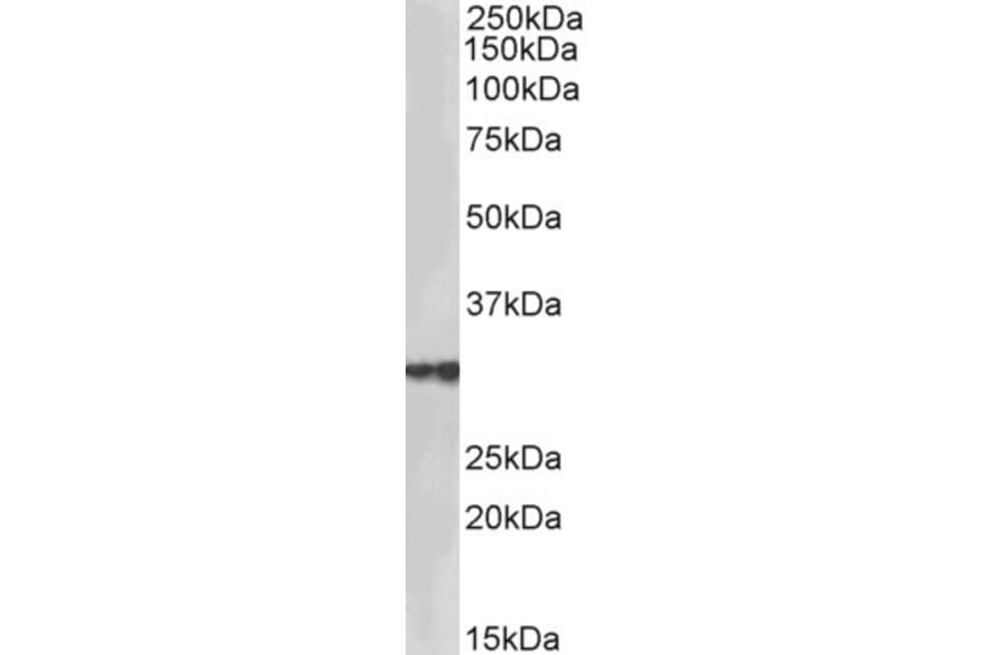 Western Blot - Anti-HSD17B3 Antibody (A85236) - Antibodies.com