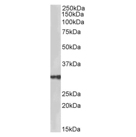 Western Blot - Anti-HSD17B3 Antibody (A85236) - Antibodies.com