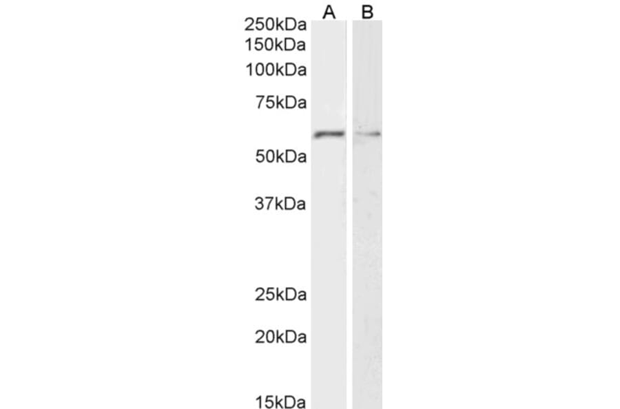 Western Blot - Anti-Glypican 1/GPC1 Antibody (A85240) - Antibodies.com