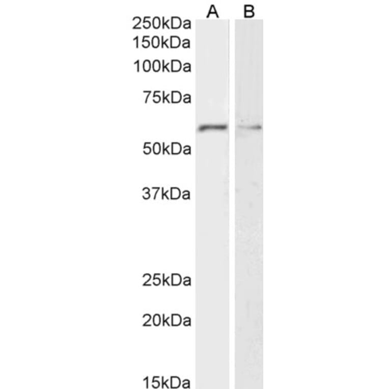 Western Blot - Anti-Glypican 1/GPC1 Antibody (A85240) - Antibodies.com
