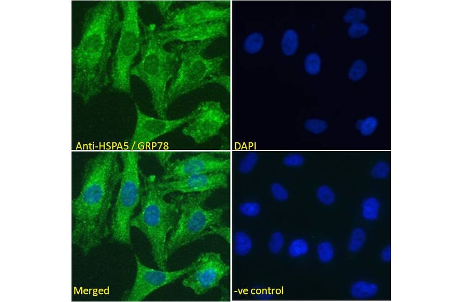 Immunofluorescence - Anti-GRP78 BiP Antibody (A85241) - Antibodies.com