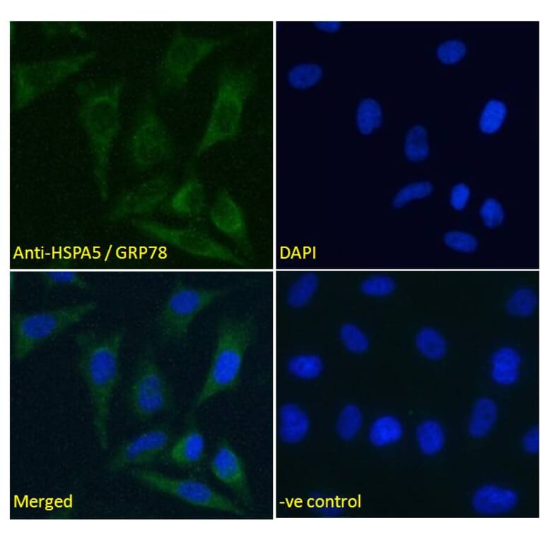 Immunofluorescence - Anti-GRP78 BiP Antibody (A85242) - Antibodies.com