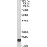 Western Blot - Anti-Fragilis Antibody (A85243) - Antibodies.com