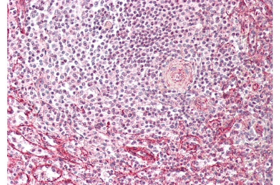 Immunohistochemistry - Anti-Fragilis Antibody (A85243) - Antibodies.com