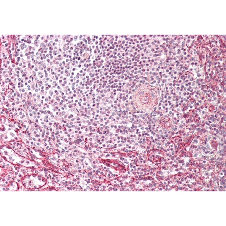 Immunohistochemistry - Anti-Fragilis Antibody (A85243) - Antibodies.com