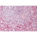 Immunohistochemistry - Anti-Fragilis Antibody (A85243) - Antibodies.com