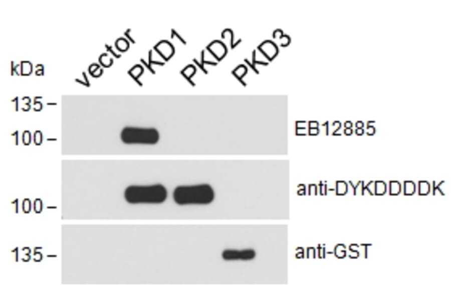 Western Blot - Anti-PKD Antibody (A85244) - Antibodies.com