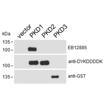 Western Blot - Anti-PKD Antibody (A85244) - Antibodies.com