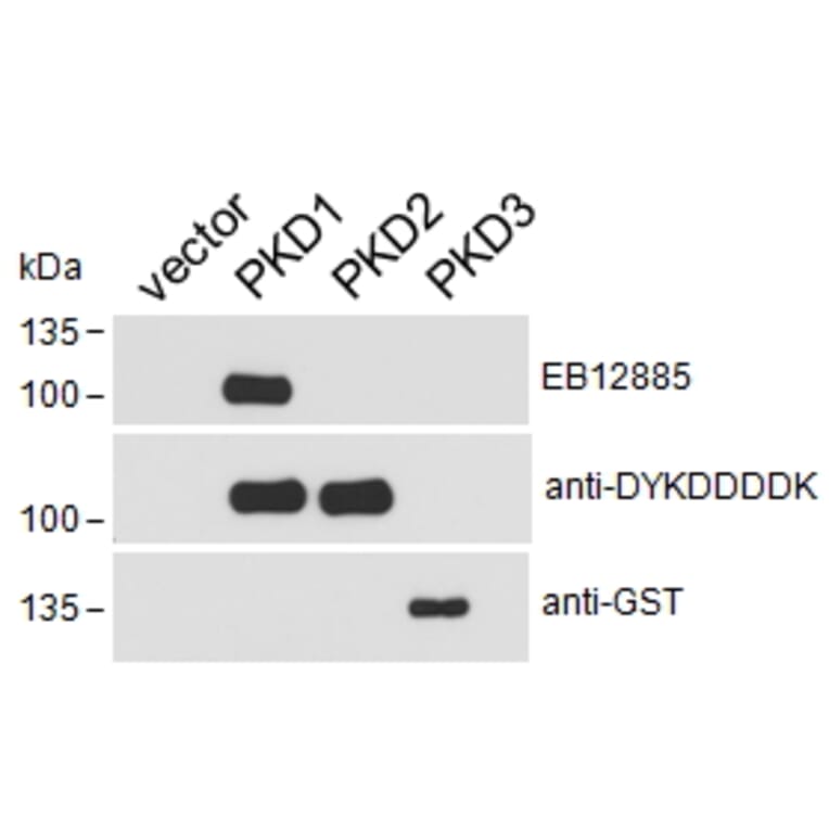 Western Blot - Anti-PKD Antibody (A85244) - Antibodies.com