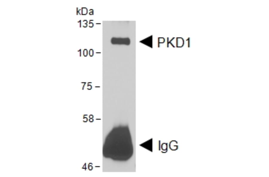 IP/Western Blot - Anti-PKD Antibody (A85244) - Antibodies.com