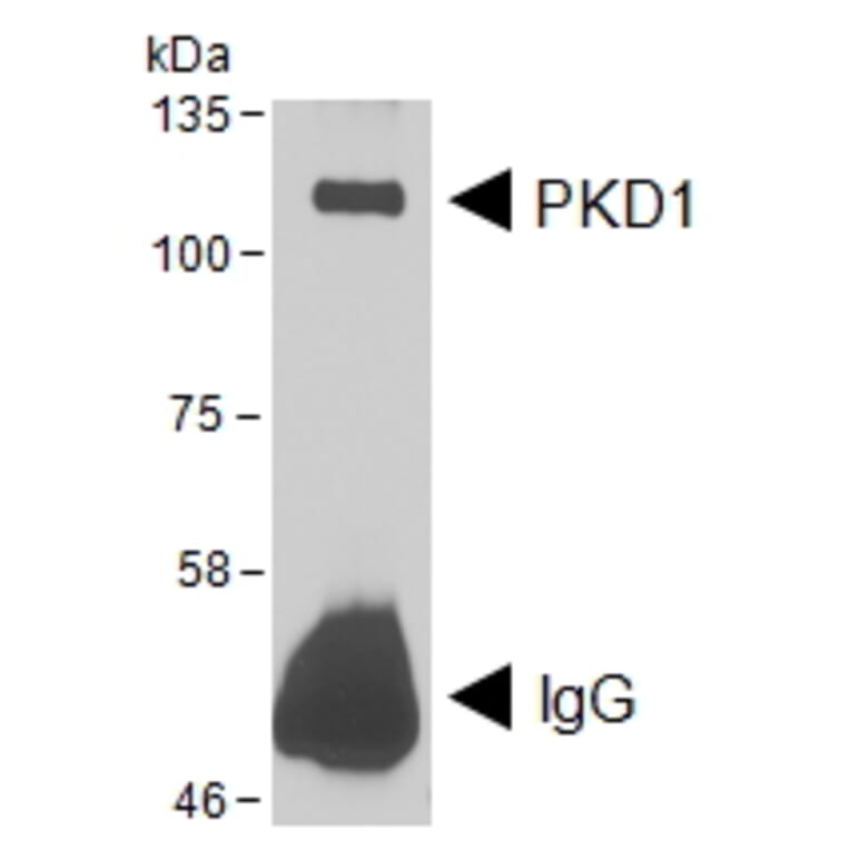 IP/Western Blot - Anti-PKD Antibody (A85244) - Antibodies.com