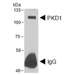 IP/Western Blot - Anti-PKD Antibody (A85244) - Antibodies.com