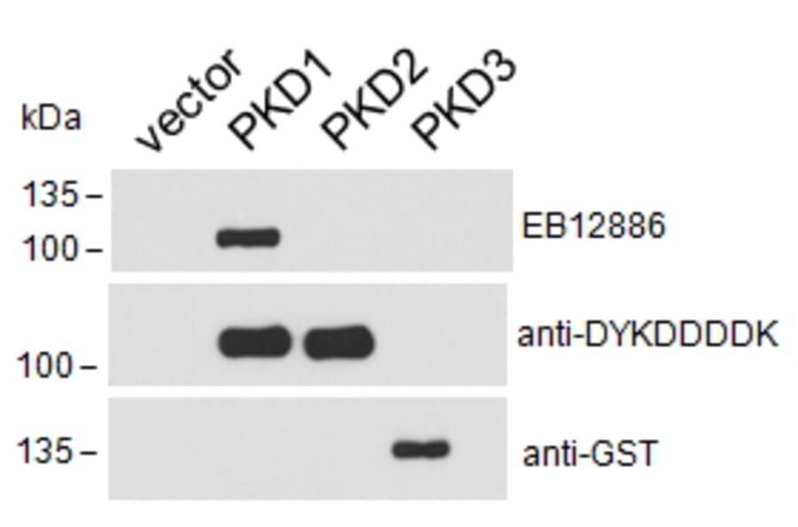 Western Blot - Anti-PKD Antibody (A85245) - Antibodies.com