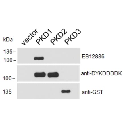 Western Blot - Anti-PKD Antibody (A85245) - Antibodies.com