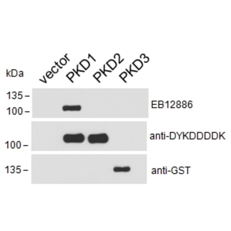 Western Blot - Anti-PKD Antibody (A85245) - Antibodies.com