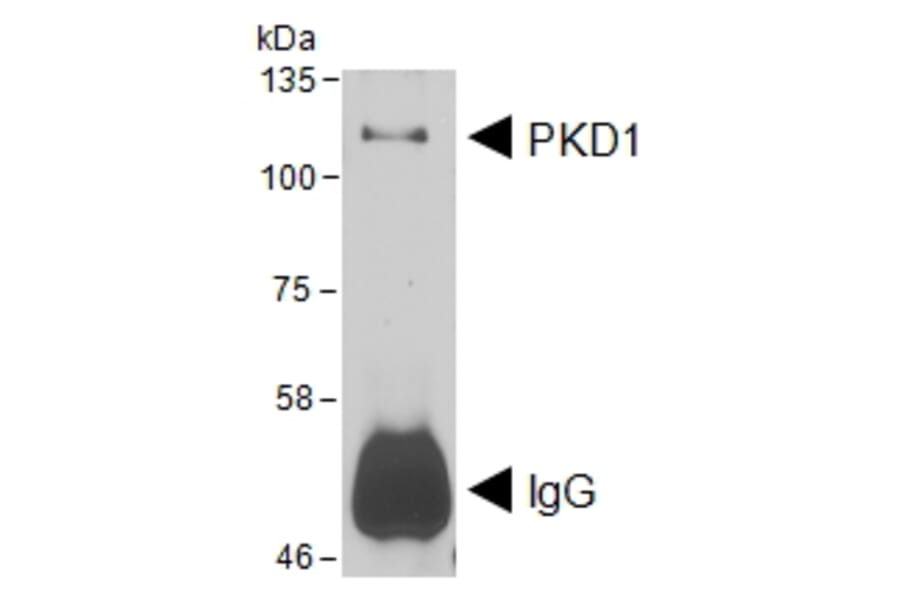 IP/Western Blot - Anti-PKD Antibody (A85245) - Antibodies.com