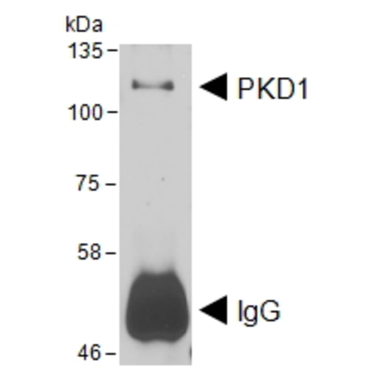 IP/Western Blot - Anti-PKD Antibody (A85245) - Antibodies.com