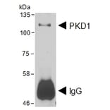 IP/Western Blot - Anti-PKD Antibody (A85245) - Antibodies.com