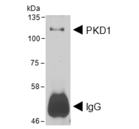 Western Blot - Anti-PRKD1 Antibody (A85245) - Antibodies.com