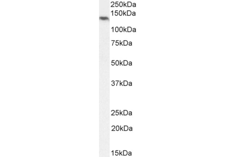 Western Blot - Anti-NALP5 Antibody (A85246) - Antibodies.com