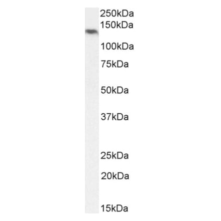 Western Blot - Anti-NALP5 Antibody (A85246) - Antibodies.com
