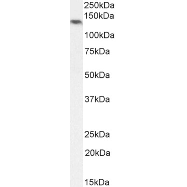 Western Blot - Anti-NALP5 Antibody (A85246) - Antibodies.com