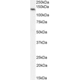 Western Blot - Anti-NALP5 Antibody (A85246) - Antibodies.com