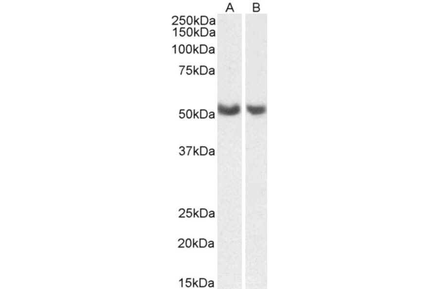 Western Blot - Anti-PTGIS Antibody (A85248) - Antibodies.com