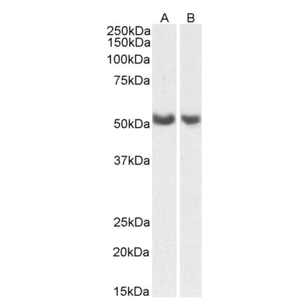 Western Blot - Anti-PTGIS Antibody (A85248) - Antibodies.com